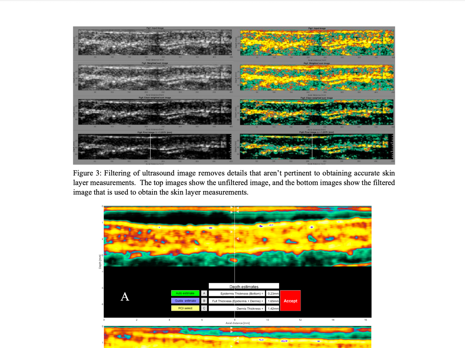 Clinical Paper: Calibration Study of the UltraVision™ Device