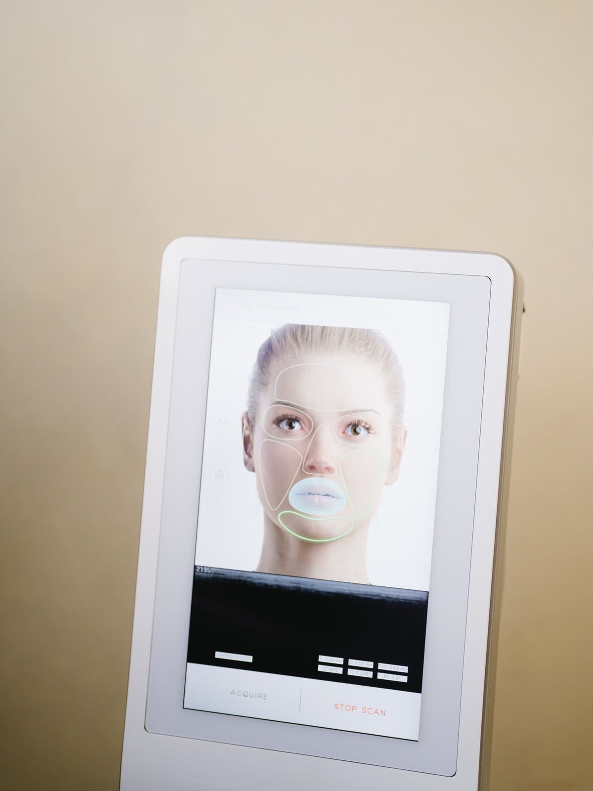 UltraVision RF touchscreen displaying AI-powered facial mapping and treatment zone scan
