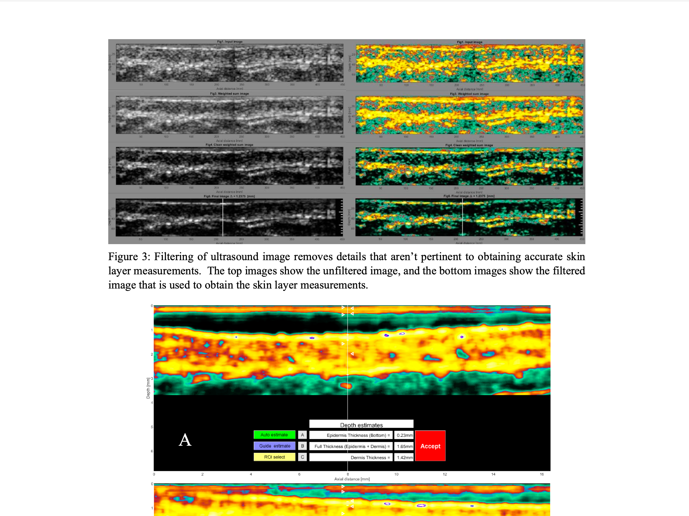 Clinical Paper: Calibration Study of the UltraVision™ Device